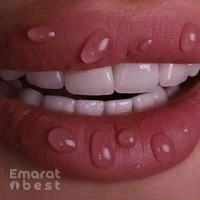 Digital Implant Clinic