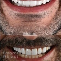 ALMA Dental Clinic | Best Dental Clinic in Dubai