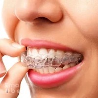 Apex Dental Clinics Motor city