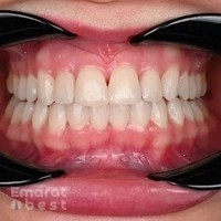 Dr.Akram Altawachi orthodontics & Invisalign