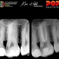Marc Habib Endodontics - Root Canal Specialist - Best Endodontist in Dubai - Root Canal Treatment