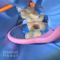 Dr. Bhavna Sharma | Best Endodontist in Dubai