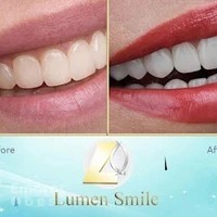 Lumen Smile