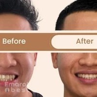 Dr Nikhil Sharma - Best Orthodontist in Dubai | Invisalign Braces, Teeth Aligners, Damon Braces, Lingual Braces