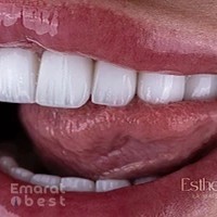 Esthetic Dubai ( La Maison Des Sourires )