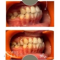 Dr. Praveena Amruthakavi - Specialist Prosthodontist & Cosmetic Dentist