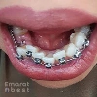 Avance Dental Clinic - Dentist in IBN Battuta