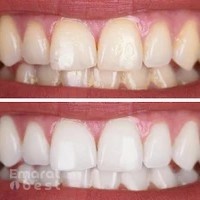 Tooth-Tastic