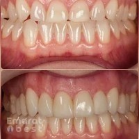 Dr Ritul Agarwal - Cosmetic Dentist