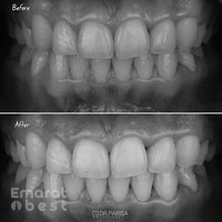 NOA Dental Clinic DMCC - JLT