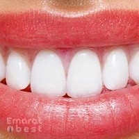 Al Najma Dental Clinic