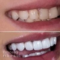 Al Najma Dental Clinic