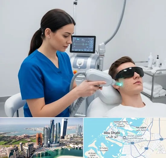 Acne Scar Treatment in Abu Dhabi