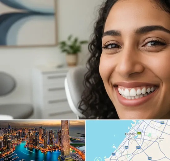 Dental Veneers in Dubai
