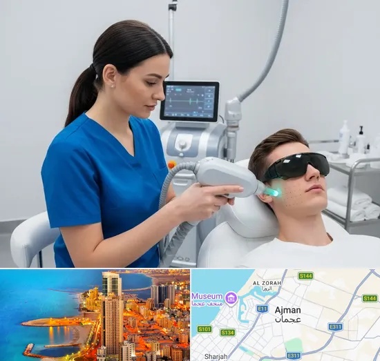 Acne Scar Treatment in Ajman