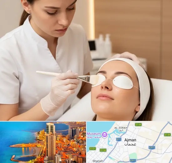 Chemical Peels in Ajman