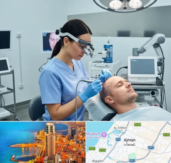 FUE Hair Transplant in Ajman