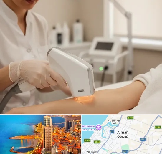 IPL Hair Removal in Ajman