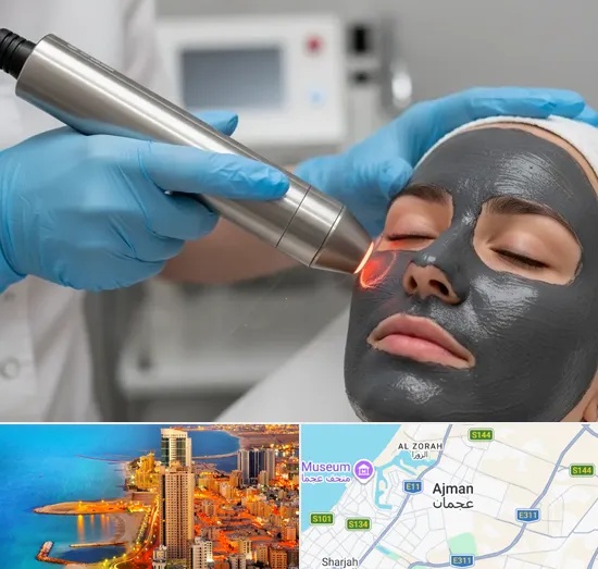 Carbon Laser Peel in Ajman