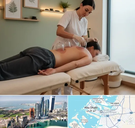 Cupping in Abu Dhabi