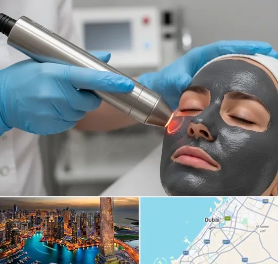 Carbon Laser Peel in Dubai