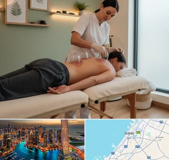Cupping in Dubai