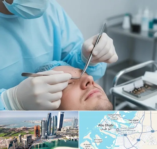 Beard Transplant in Abu Dhabi
