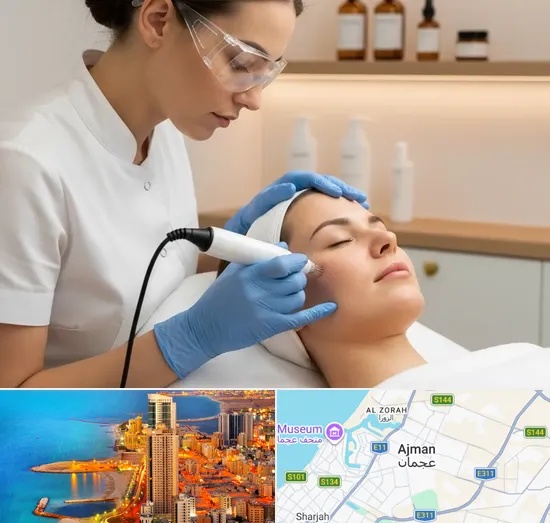 Microneedling in Ajman