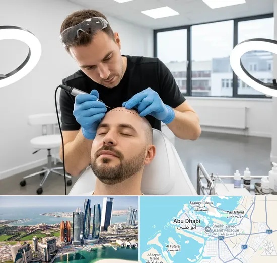 Scalp Micropigmentation in Abu Dhabi