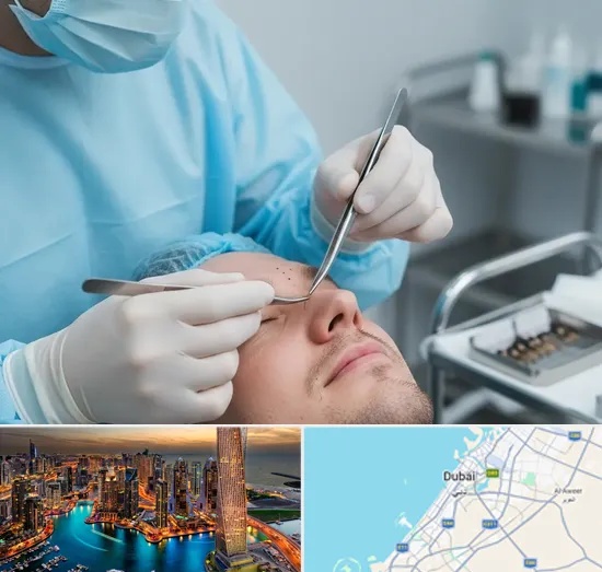Beard Transplant in Dubai
