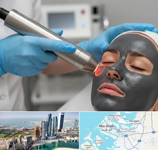Carbon Laser Peel in Abu Dhabi