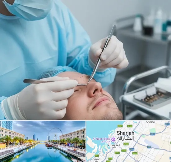 Beard Transplant in Sharjah