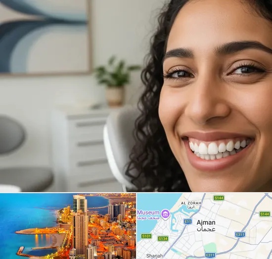 Dental Veneers in Ajman