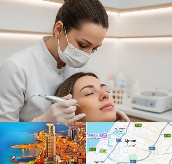 PRP Therapy in Ajman