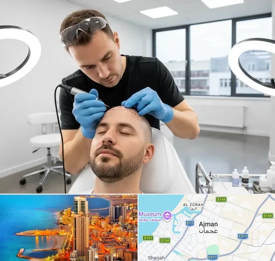Scalp Micropigmentation in Ajman