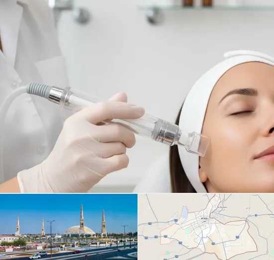 HydraFacial in Al Ain