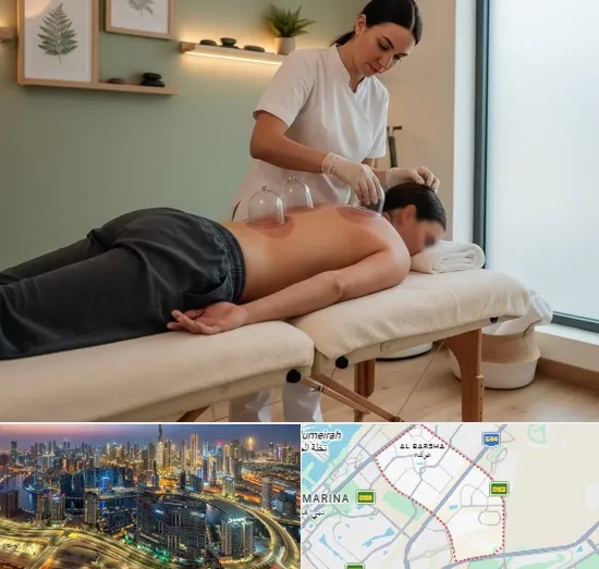 Cupping in Al Barsha