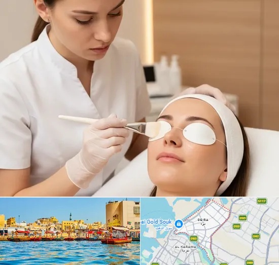 Chemical Peels in Deira