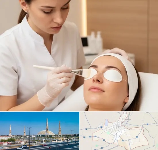Chemical Peels in Al Ain