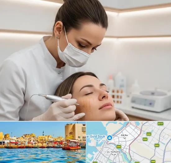 PRP Therapy in Deira