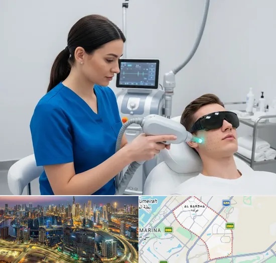 Acne Scar Treatment in Al Barsha