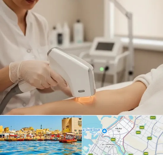 IPL Hair Removal in Deira