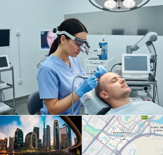 FUE Hair Transplant in Business Bay