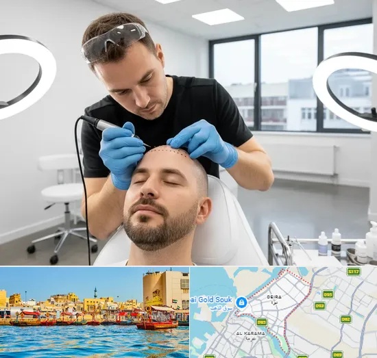 Scalp Micropigmentation in Deira
