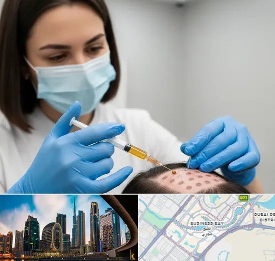 PRP Hair Treatment in Business Bay
