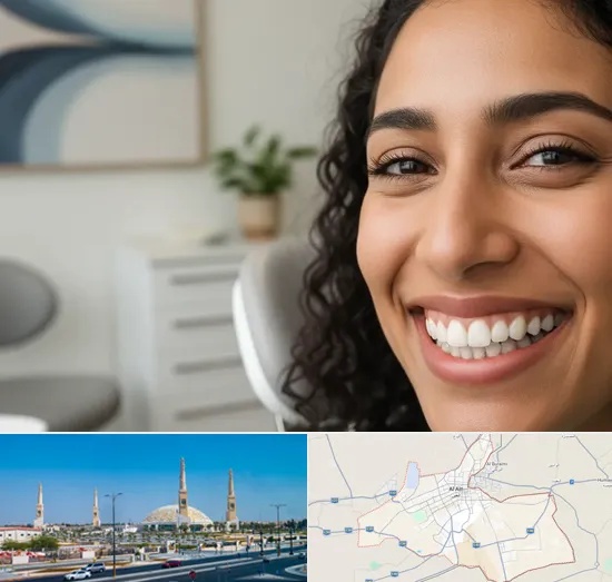 Dental Veneers in Al Ain