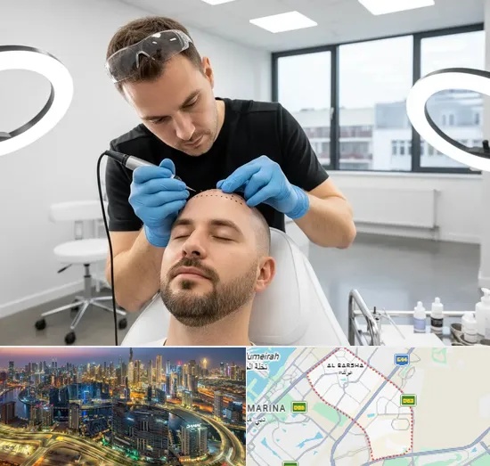 Scalp Micropigmentation in Al Barsha