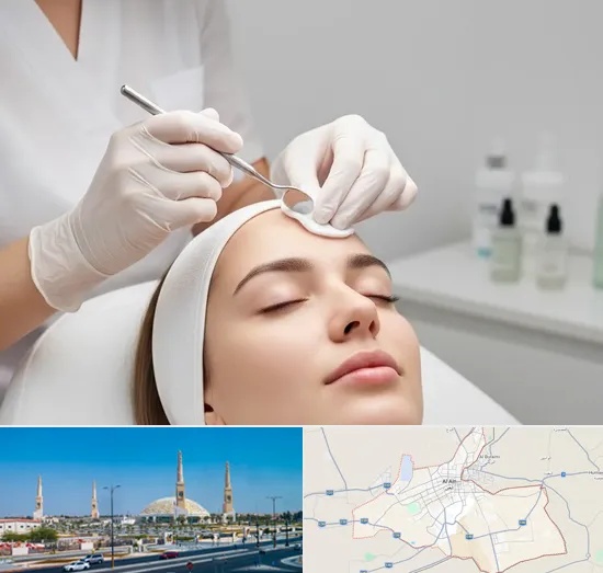 Facial Extractions in Al Ain