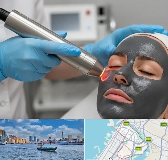 Carbon Laser Peel in Bur Dubai