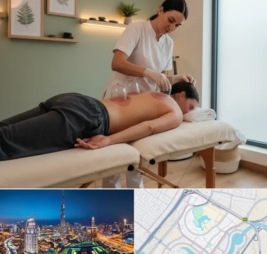 Cupping in Downtown Dubai